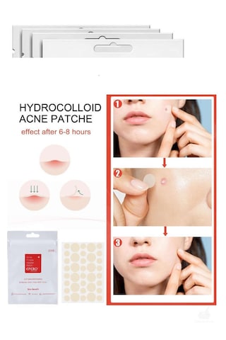 Tbyshop Akne Sivilce Bandı - Acne Patch