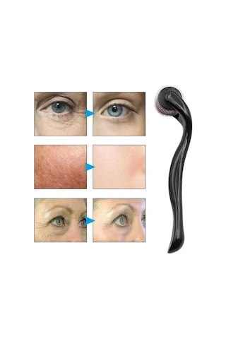 Zenvia Dermaroller Titanyum 540 Iğneli 1 Mm Saç Kaş Sakal Serum Kullanıma Uygun Znv2026 98663398