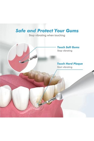 Jialan Ultrasonik Ölçekleyici Diş Scalers Temiz Diş Taşı