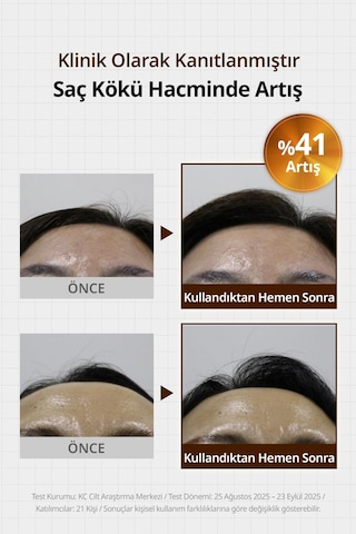 Saç Dökülmesi Karşıtı Ferahlatan Köklere Hacim Sunan Tonik Kundal Beer Yeast Extra Root Volume Tonic