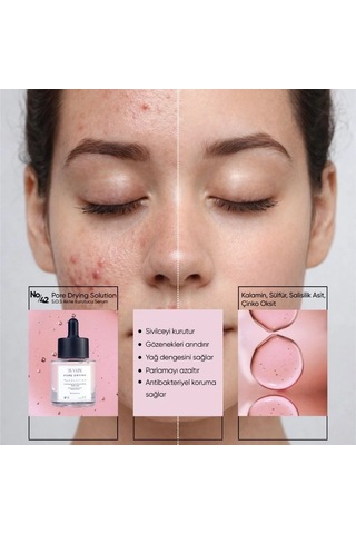 Ds V-Line Sebum Dengeleyici Sulfur Serum 30 ML