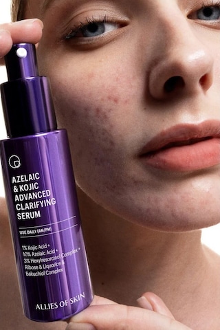 Allıes Of Skın Azelaic & Kojic Serum,leke, Gözenek Ve Sebum Dengesi Için Arındırıcı Bakım