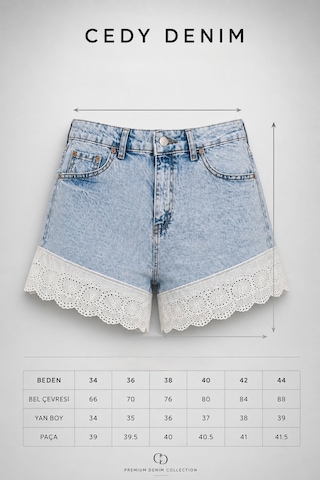 Cedy Denim Cedy Denım-kadın Kar Yıkama Paçası Fisto Güpür Detaylı Yüksek Bel Denim Jean Şort E7017
