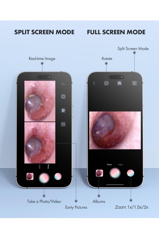 Anykit Dijital Otoskop, Ultra Net Görüşlü Kulak Kamerası - İpad/iphone/android