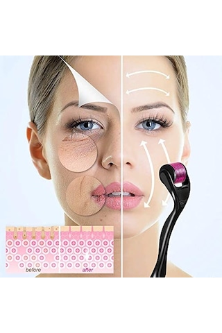 Yüz, Vücut Ve Saç Derisi İçin Derma Roller 1.0mm - 540 Micor Roller İle Erkekler Ve Kadınlar İçin Derma Rulo - Saç Ve Sakal İçin Sakal Rulo