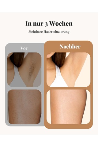 Haarlosy Ipl Cihazları Evde Salon Kalitesinde Uzun Süreli Sonuçlar Veren Kadınlar Ve Erkekler İçin Epilasyon Lazeri, Yüz, Bikini Bölgesi Ve Vücut İçin Ağrısız Ipl Epilasyon Cihazı