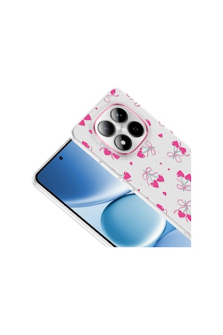 Redmi Note 15 Pro 4g Kılıf Kamera Korumalı Desenli Klip Kılıf Kalpli Kiraz