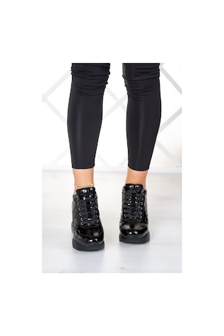 Erkan Saçmacı Maria Siyah Gizli Dolgu Günlük Ayakkabı