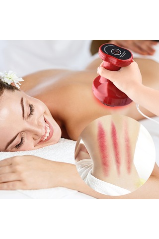 Youtek Elektrikli Isıtmalı Vakum Kan Grubu Cihazı - Akupunktur Noktalarını Uyararak Vücut Bakımı Ve Zayıflama İçin Fizyoterapi Aleti Usb İle Şarj Edilebilir Kırmızı