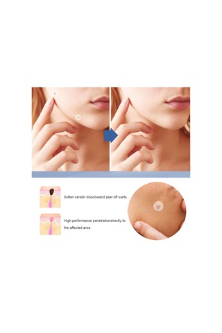 Vkemall Eelhoe Doğal İçerikli Siğil Yapışkanları 144 Adet, Ağrısız Cilt Temizliği, Her Cilt Tipi İçin Uygun, Su Geçirmez Ve Nefes Alabilir.