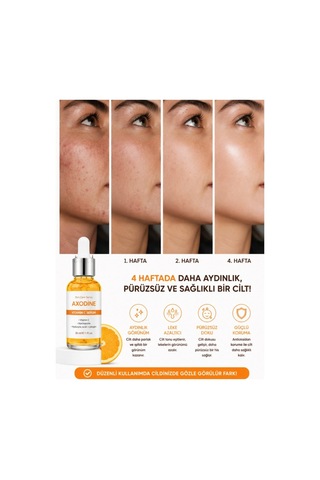 Axodine C Vitamini Aydınlatıcı ve Ton Eşitleyici Bakım Serumu 30 ML