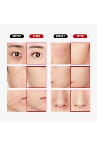 Merythod Dual Concealer 02 Natural Beige - Çift Uçlu Kapatıcı Stick Ve Likit