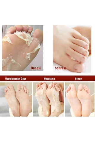 Miracle Foot Peeling Pack-çorap Tipi Ayak Peeling Maskesi