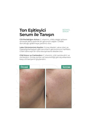 Ton Eşitleyici,leke Karşıtı Aydınlatıcı Retinol Serum 50ml