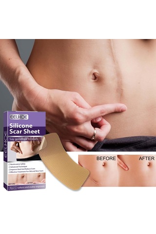 Dolıty Yanık İzleri Skar Yaması Çok Kullanımlı Yumuşak