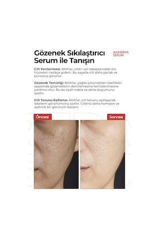 Aha & Bha Canlandırıcı,gözenek Sıkılaştırıcı Ve Nemlendirici Serum 50ml