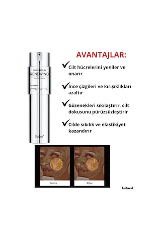Sudee 100 Pdrn Renewing Serum 2ml 10 Adet Pdrn Ve Mikroiğneli 100 Güçlendirici Serum
