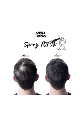 Root Touch Up Sprey / Saç Dolgunlaştırıcı Ve Seyrek Kapatıcı / Suda Yağmurda Akmaz/ Siyah 100 Ml