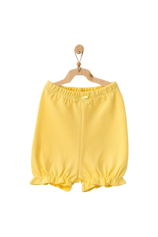 Dear Enika Andywawa Kız Bebek Ananas Desenli Alt Üst Sarı Şort Takım Ac21633r 001