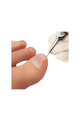 Moveevo Ayak Tırnağı Düzeltme Alet Seti 3 50 Batık Tırnak Düzeltme Pedi, 3 Parçalı Batık Tırnak Alet Seti