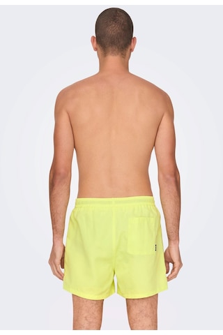 Only & Sons Erkek Onsted Deniz Şortu 22021832 Limon Narçiçeği