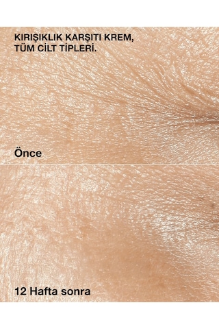 Smart Clinical Repair Rich- Kırışıklıkları Hedefleyen Yaşlanma Karşıtı Yoğun Bakım Kremi 50ml