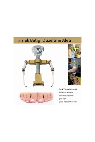 Coverzone Batık Tırnak Düzeltme Aleti - Vida Mekanizması Ve İki Tırnak Kancasıyla Etkili Batık Tırnak Tedavisi