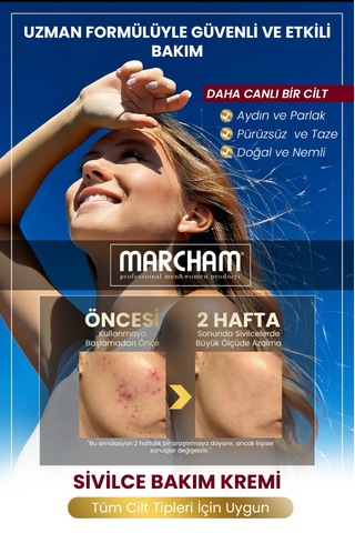 Marcham Akne Ve Siyah Nokta Giderici