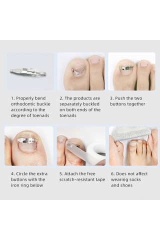 Mufunye Pratik Tırnak Düzeltme Aracı: Paslanmaz Çelik Ve Abs Malzeme, 1 Veya 2 Adet Seçenekli