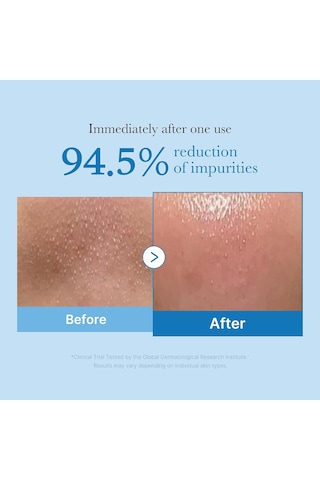 Medicube Medicube - Zero Pore Blackhead Deep Cleansing Oil Siyah Nokta Giderici Derin Temizleyici Yağ Kbeautyflashsale