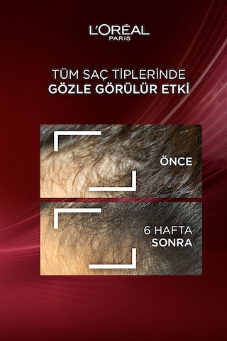 ELSEVE Komple Direnç Dökülme Karşıtı Şampuan 300 ml