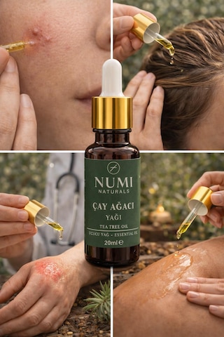 Çay Ağacı Yağı 20 Ml Saf Tea Tree Oil Uçucu Yağ, Cilt Ve Aromaterapi Yağı