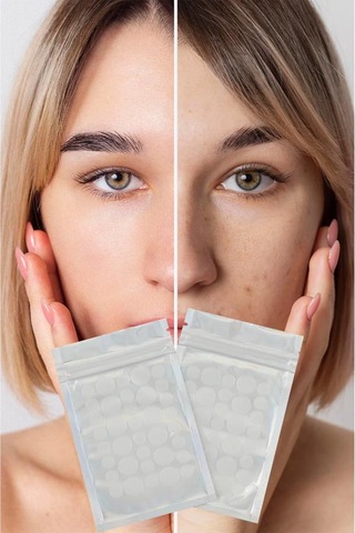 Akne Sivilce Siyah Nokta Bandı 72 Adet Sos Band Bant