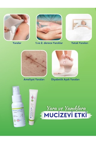 Actolind W Solutıon 50 ML & Actolind W Yara Jeli 30 ML