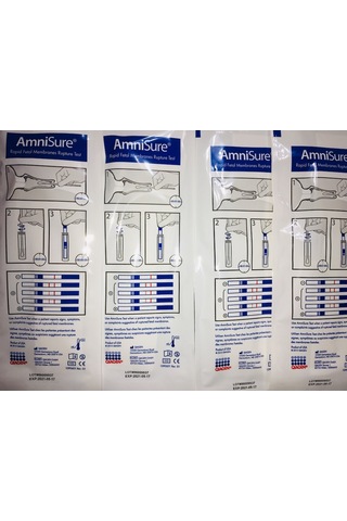 Amnisure Fetal Membran Yırtığı Testi