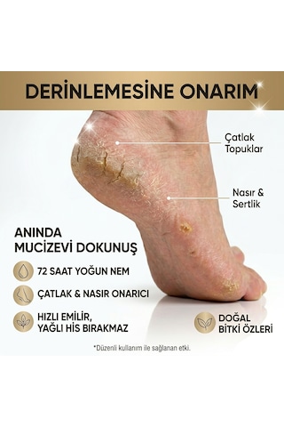 Vera Hmd Bitkisel Ayak Ve Topuk Çatlak Çatlağı Kremi 100 Ml Ayak Bakımı Ayak Kokusu Önleyici Nemlendirici Yenileyici