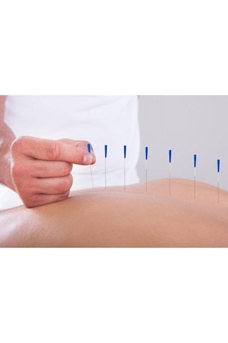 Maxi Akupunktur Iğnesi Kuru Iğne, Acupuncture Needle 0,35*60Mm Çok Renkli