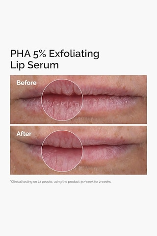 The Ordinary Pha %5 Peeling Etkili Dudak Serumu 15ml