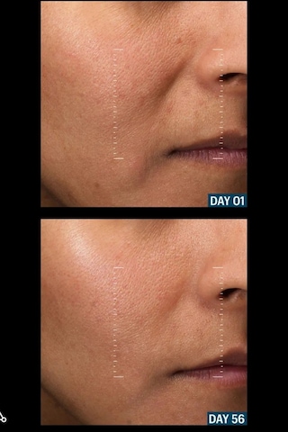 Allies Of Skin Leke Karşıtı, Aydınlatıcı, Peptit Ve Gümüş Içerikli Gece Serumu