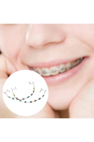 Suntek Arkadaşlar Için Geçici Diş Dekorasyonu Metal Braket