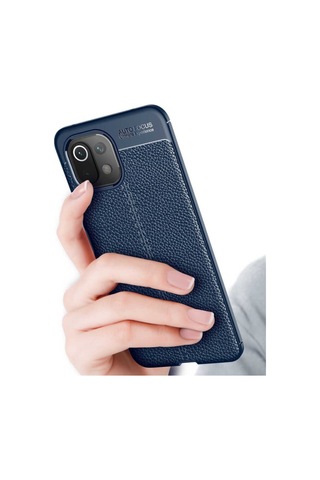 Xiaomi Mi 11 Lite Kılıf Deri Tarzı Niss Silikon Case
