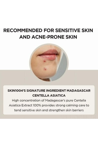 Qingmipy Skın1004 Madagascar Kentella Asiatica 100ml Ampul - Doğal İçerikli Cilt Bariyeri Güçlendirici, Nem Ve Yağ Dengeleyici