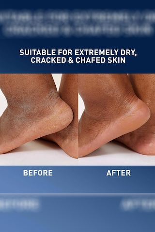 Cerave Çatlamış Ve Aşırı Kuru Ciltler İçin Balsam 85gr