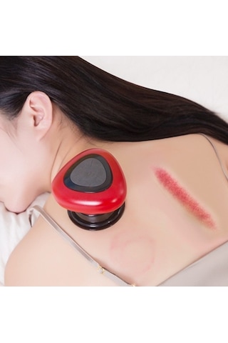 Lichen Elektrikli Hacamat Cihazı, Negatif Basınçlı Kazıma Çok Renkli