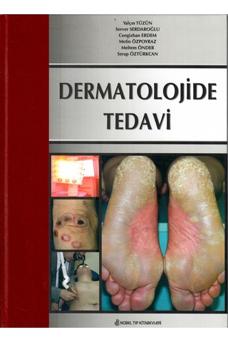 Dermatolojide Tedavi N11.1801