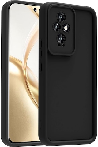 Zore Honor 200 Kılıf Kamera Korumalı Msra Ananas Kapak - Siyah Siyah
