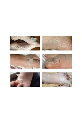 Ayak Peeling Maskesi Nasır, Ölü Deri Temizleyici, Nemlendirici Özellik, Lavanta Yağı Ve C Vitamini İçerir