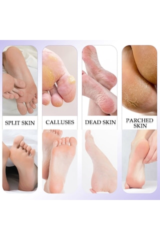 10 Adet / Takım Profesyonel Ayak Bakımı Pedikür Nasır Ölü Cilt Sökücü Ayak Dosya Mısır Temizleme Aracı