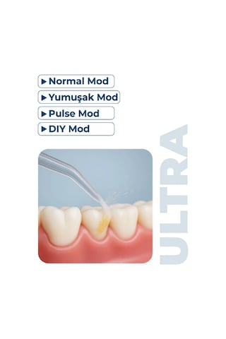 Pirantech Aquadnet Ultra Ağız Duşu Im50802002