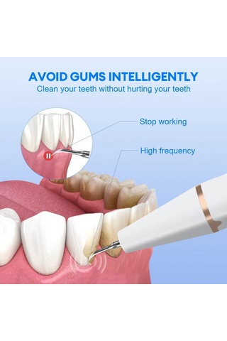 Jialan Ultrasonik Diş Ölçekleyici Ağız Bakımı Tartar Kaldırma